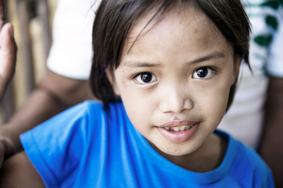 PHL_2016_Cebu_034_Jane Rose Amoro_After_
Jane Rose Amoro, 7,  #034, unilateral incomplete cleft lip, no cleft palate. Adventist Hospital. Operation Smile. Cebu. Year 17 Medical Mission. June 12-19, 2015. (Operation Smile Photo Jörgen Hildebrandt)